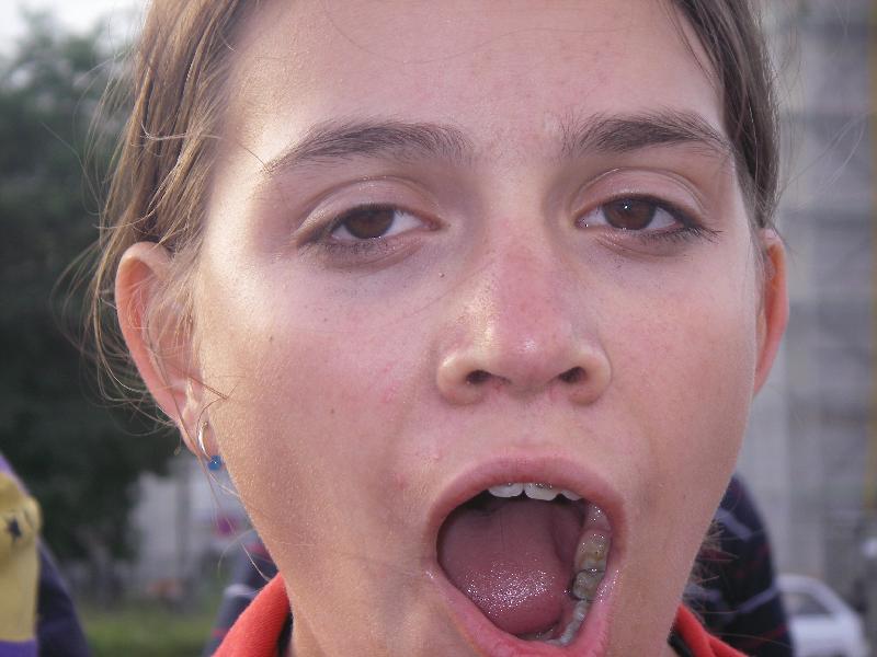 2007-06-27-rad-313 